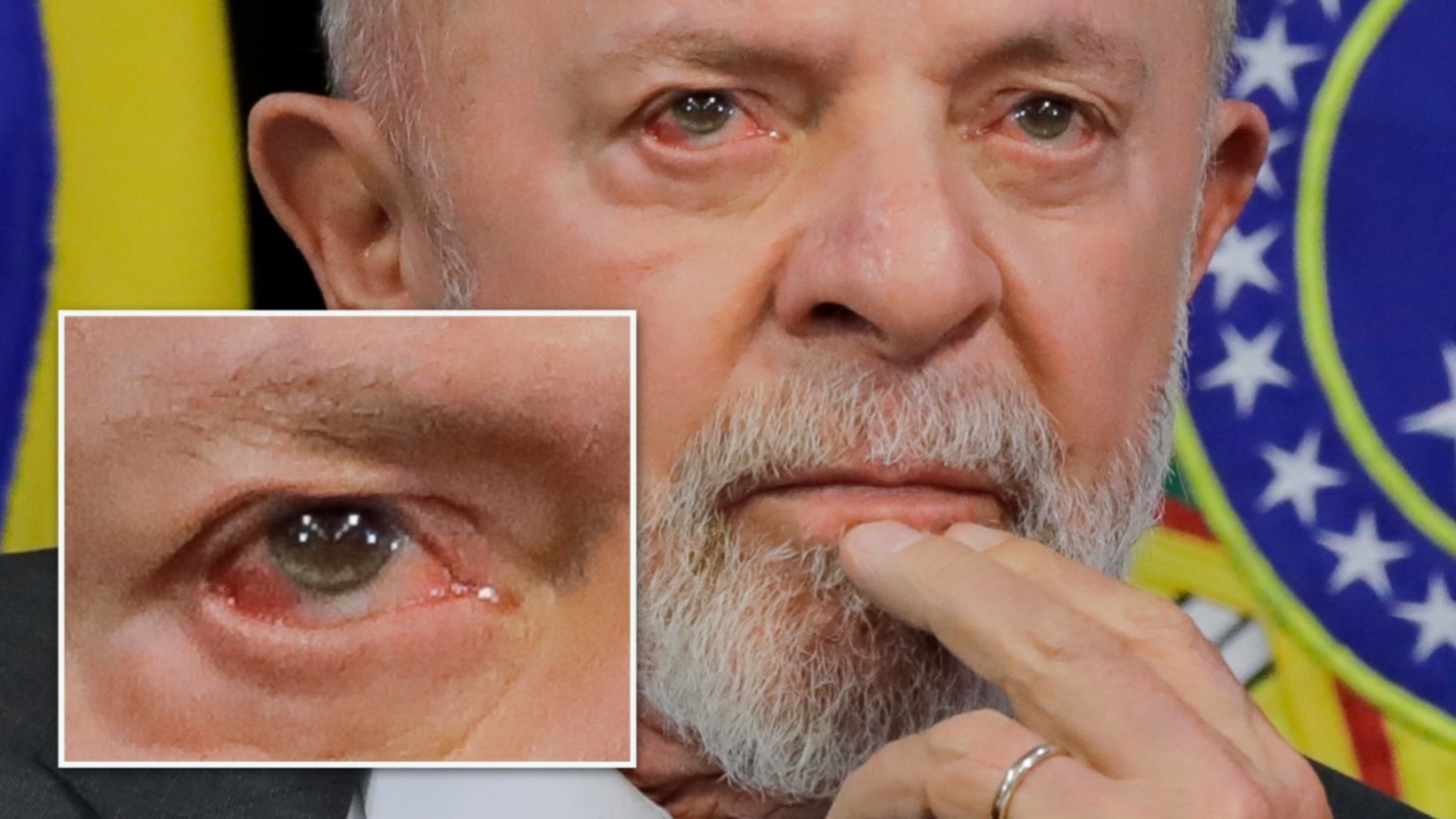 Lula é operado às pressas após sentir dor de cabeça